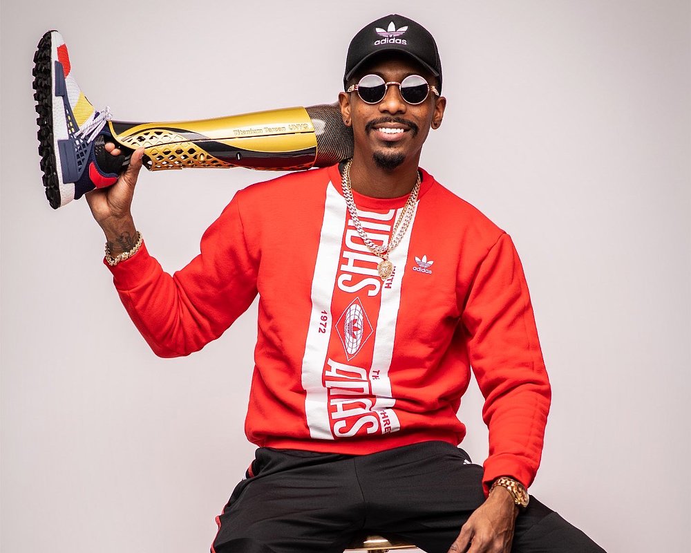 Joe Forde poses with his prosthetic leg.