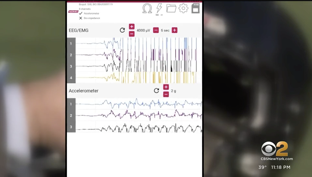 A view of the chart of the brain activity that the NoMo diagnostics helmet can read in real time