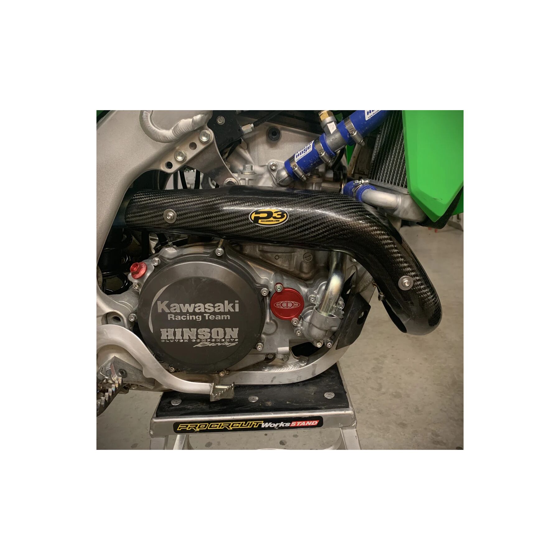 P3 Carbon Fiber Heat Shield Kawasaki KX450 / KX450X 2024-2026